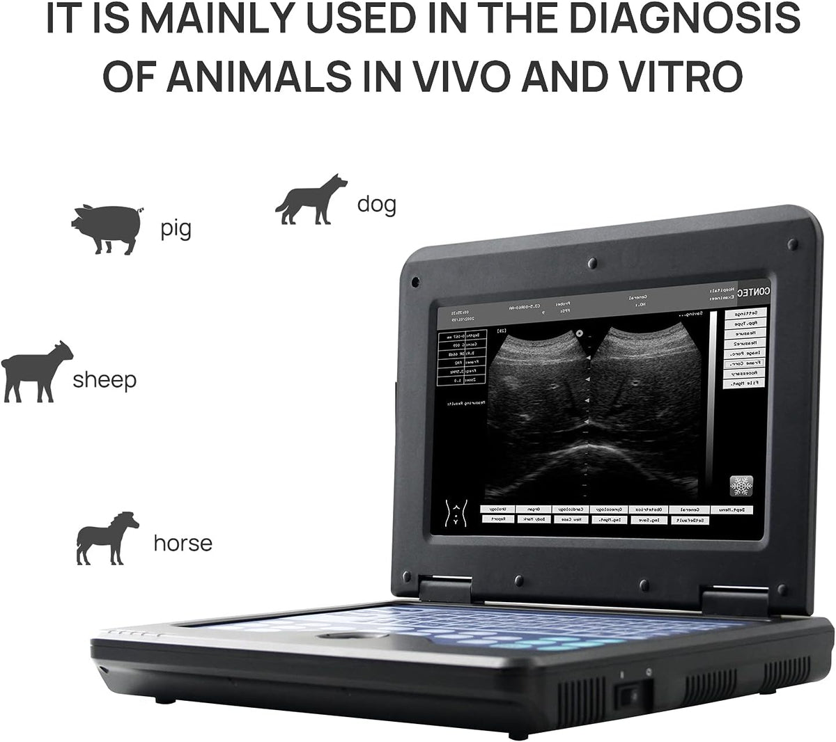 Portable Laptop B-Ultra Sound Scanner Machine with Micro-Convex & Rectal Linear Probe H33235