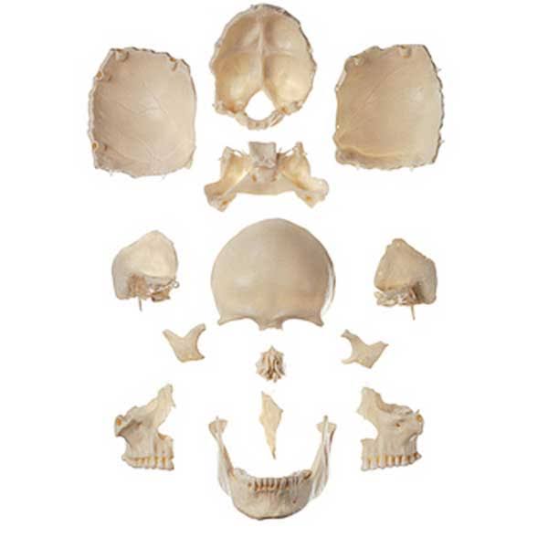 Disarticulated Human Skull S66466