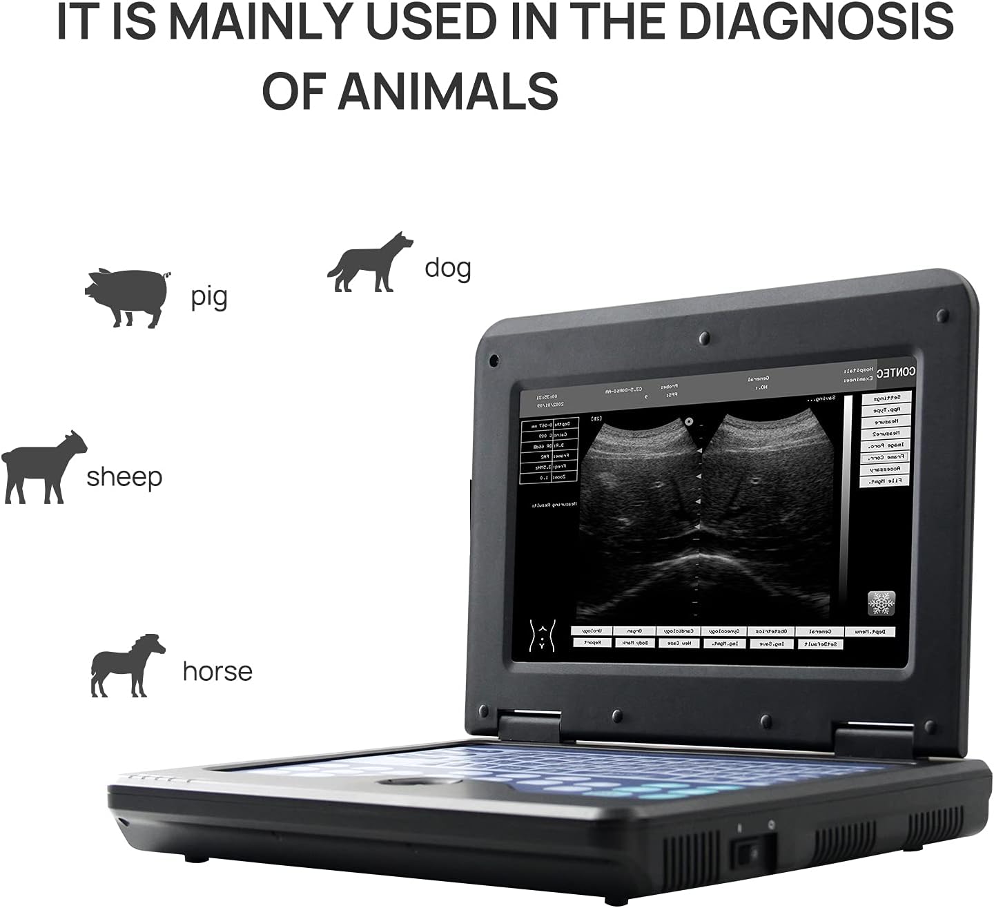 Portable Laptop B-Ultra Sound Scanner Machine with Micro-Convex & Rectal Linear Probe H33235